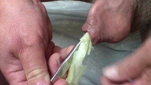 Combination - spring onion AND scissors in foreskin !
